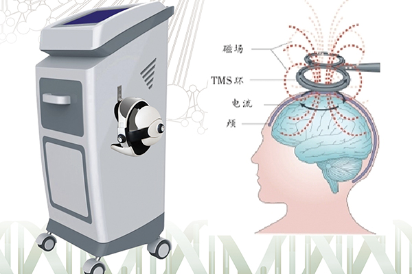 成都供应经颅磁刺激治疗仪厂家