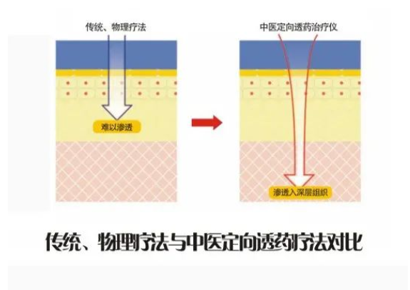 中医定向透药治疗仪.png