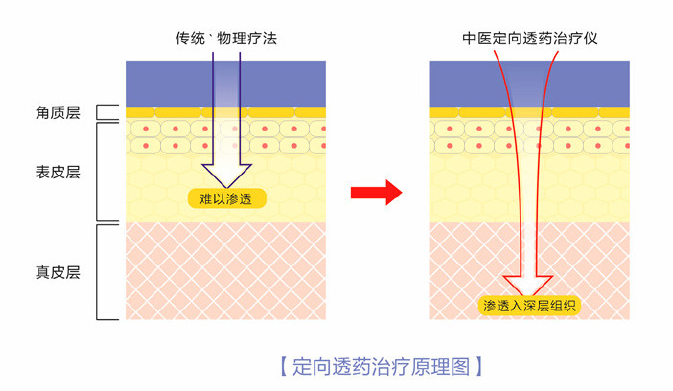 疗法对比1.png